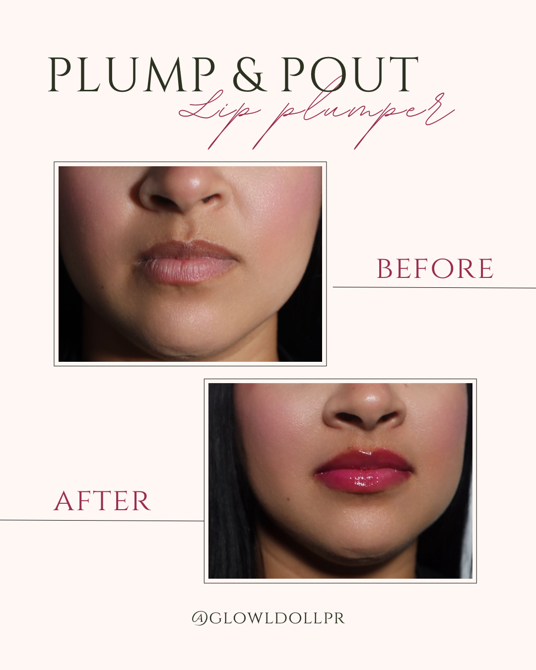 Lip plumper